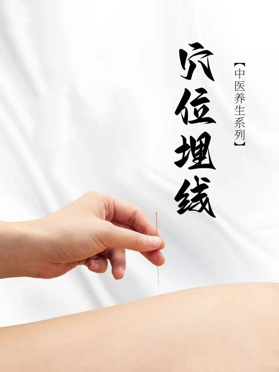 皇冠网